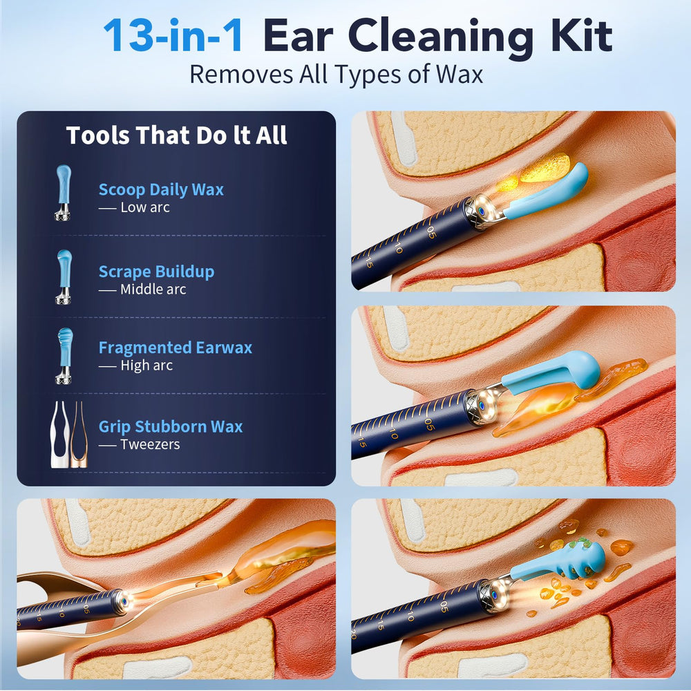 Yakbio ear cleaner camera with LED lights illuminates the canal