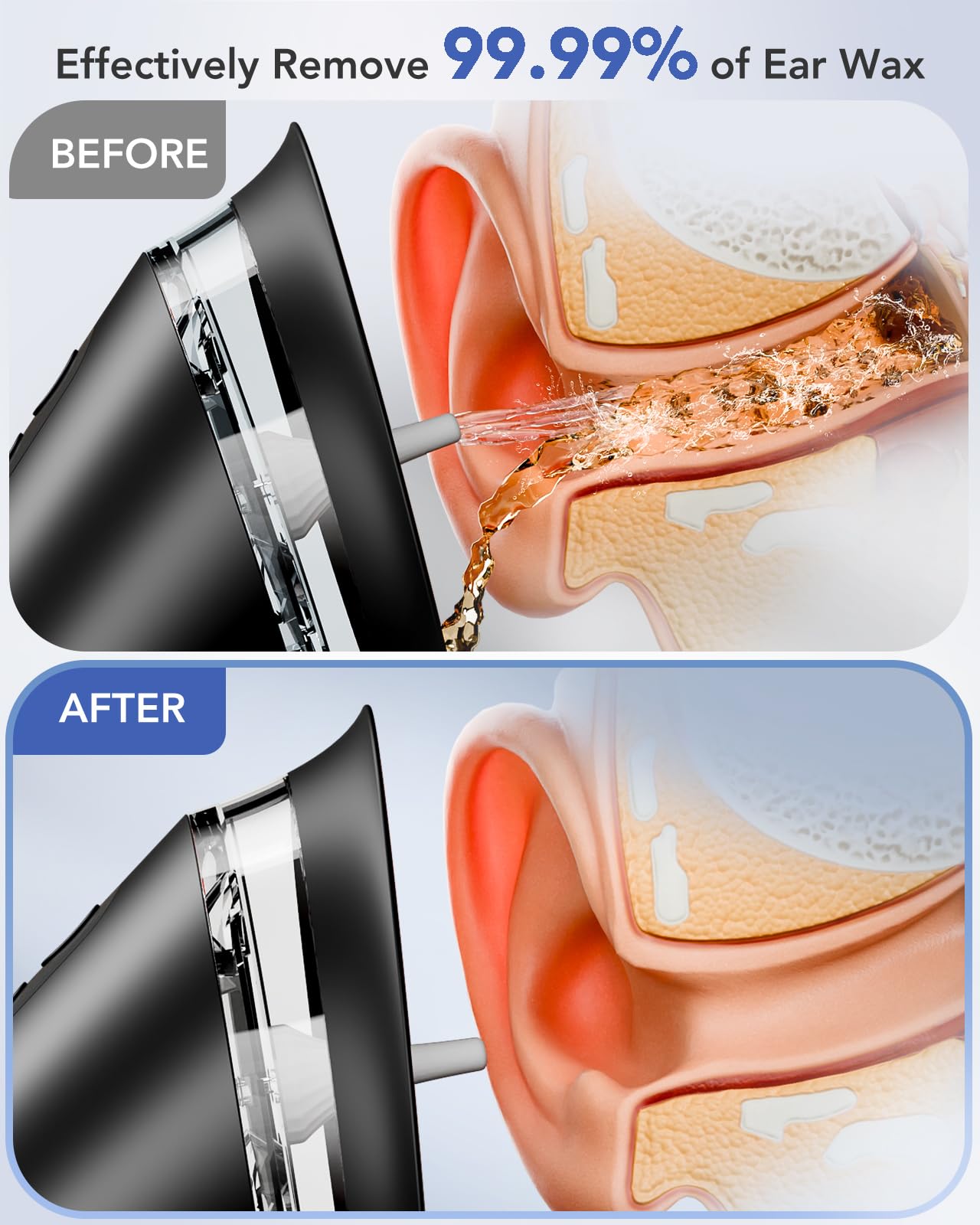 Yakbio ear cleaner with LED display shows battery level for reliable charging.