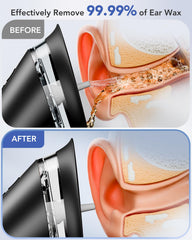 Yakbio ear cleaner with LED display shows battery level for reliable charging.