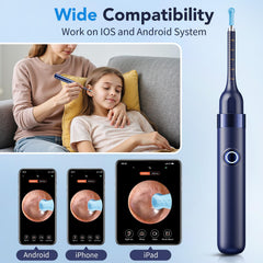 Yakbio ergonomic ear wax camera design for comfortable grip