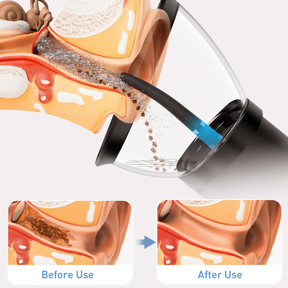 Yakbio retractable kit enables travel-friendly, compact ear care.