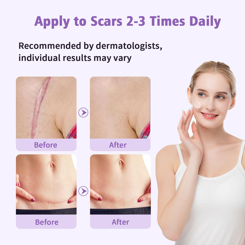 Yarster scar gel application on skin demonstrates streak-free, even coverage