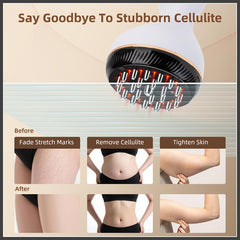Yaumany microcurrent nodes closeup for precise tissue stimulation and cellulite improvement potential.