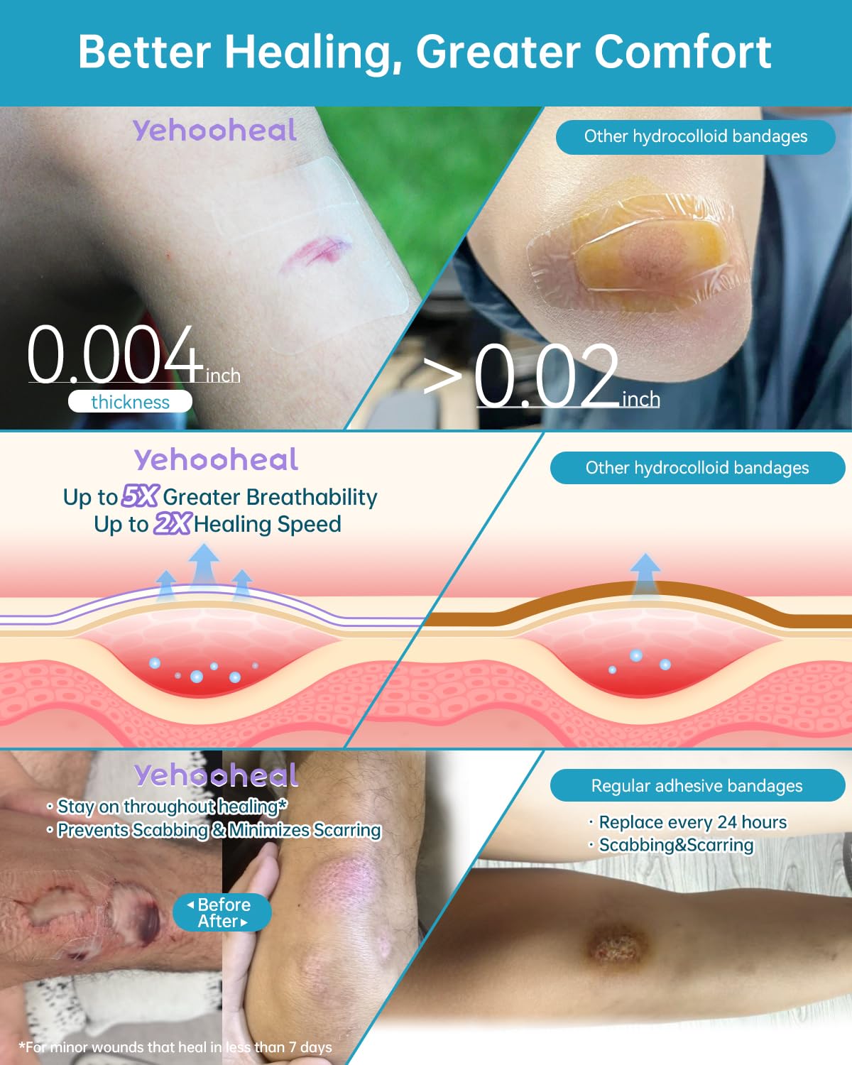 yehooheal strong adhesion supports extended wear up to seven days.