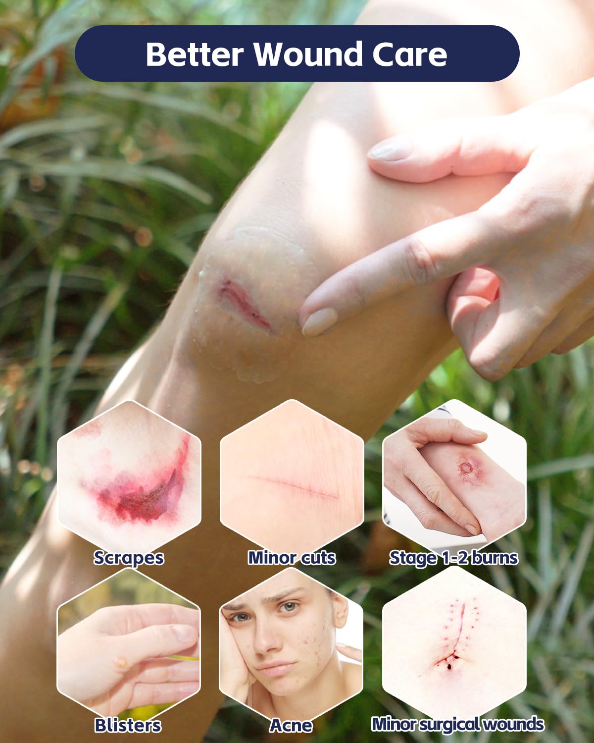 Yehooheal patch supports a moist healing environment that may aid recovery.