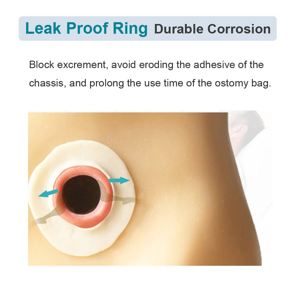 YEYSXSY skin-friendly hydrogel layer protects skin around the stoma while sealing