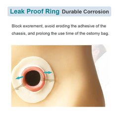 YEYSXSY skin-friendly hydrogel layer protects skin around the stoma while sealing