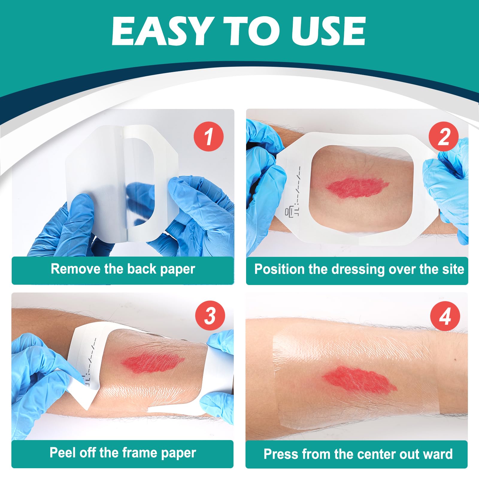 YHOVID post-surgical incision shield protects healing areas.