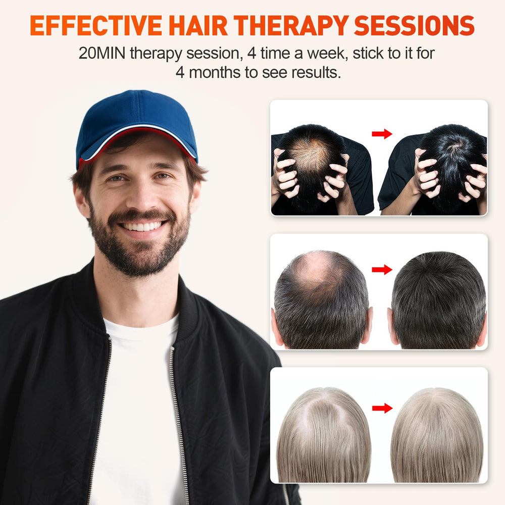 YIPFREE Red Light Cap irradiance graphic highlights strong light coverage on the scalp