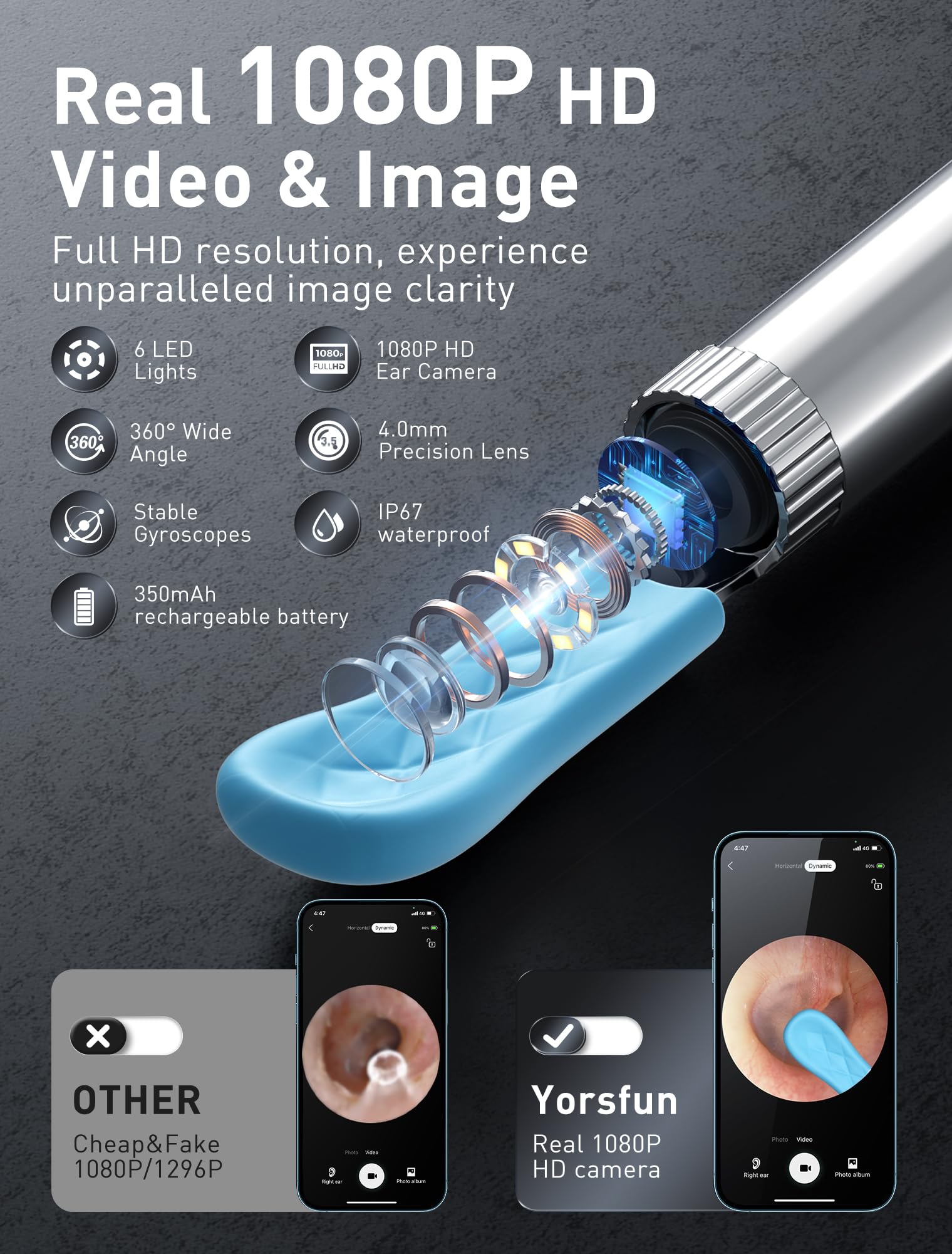 Yorsfun seven-ear-spoon kit enables precise wax removal