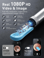 Yorsfun seven-ear-spoon kit enables precise wax removal