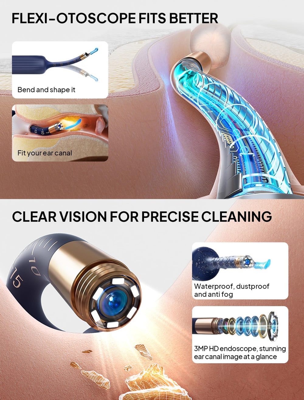 Yumika ear scope with flexible tip enables gentle removal while watching in real time.