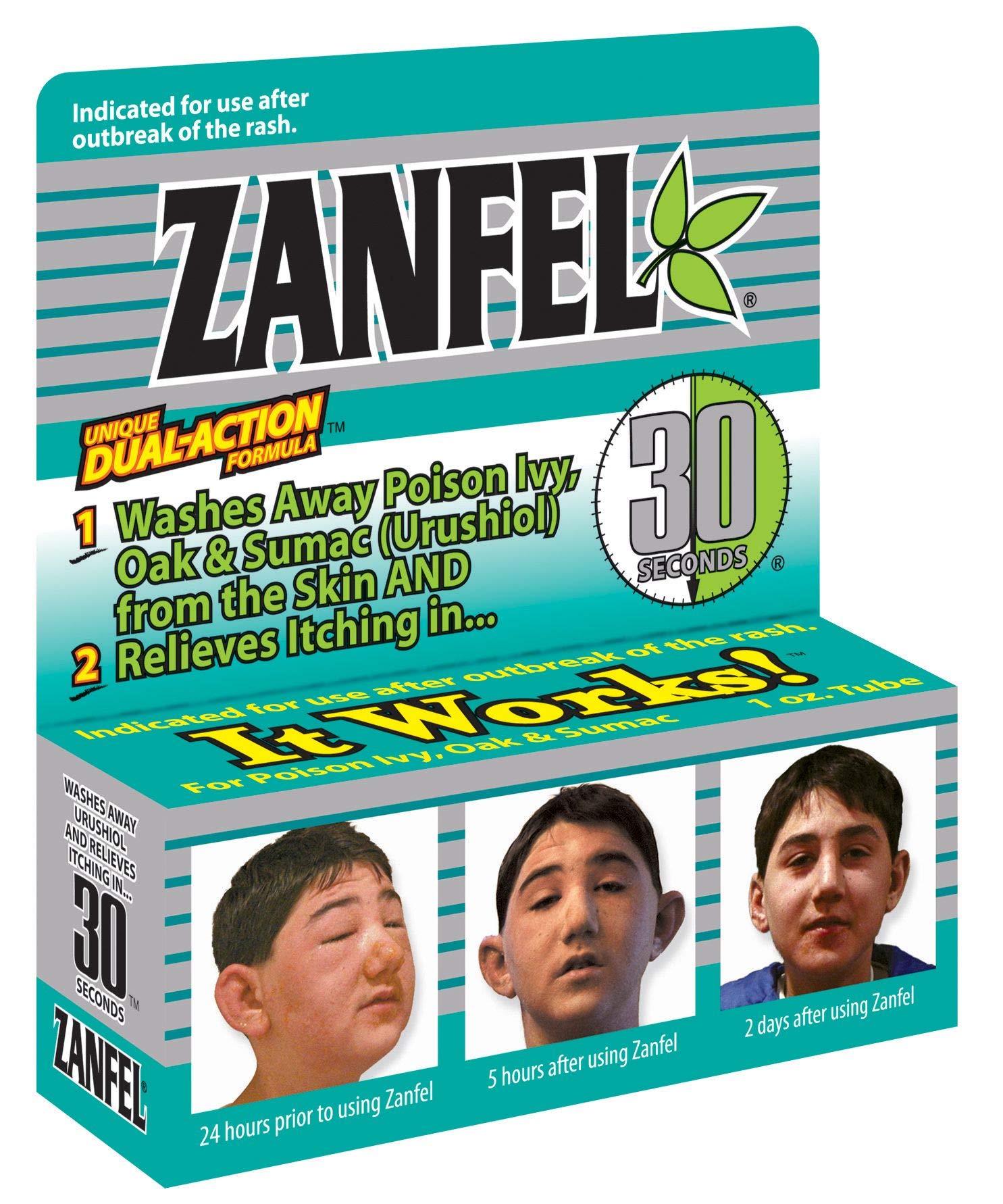Zanfel ivy, oak, and sumac wash applied to skin after exposure.