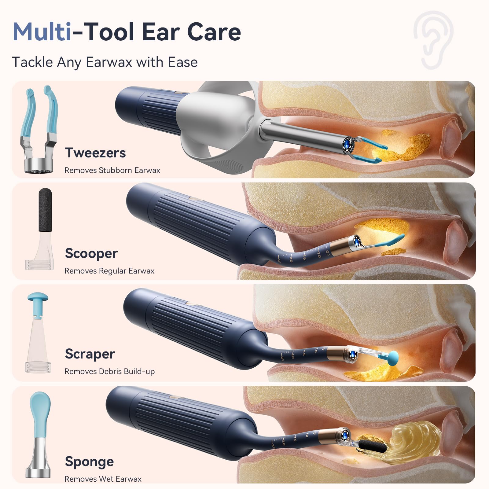 ZERONDER ear-tweezers offer gentle removal with minimal canal contact.