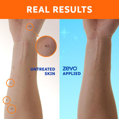 ZEVO On-Body face-and-body application with palm-dab for precise coverage.
