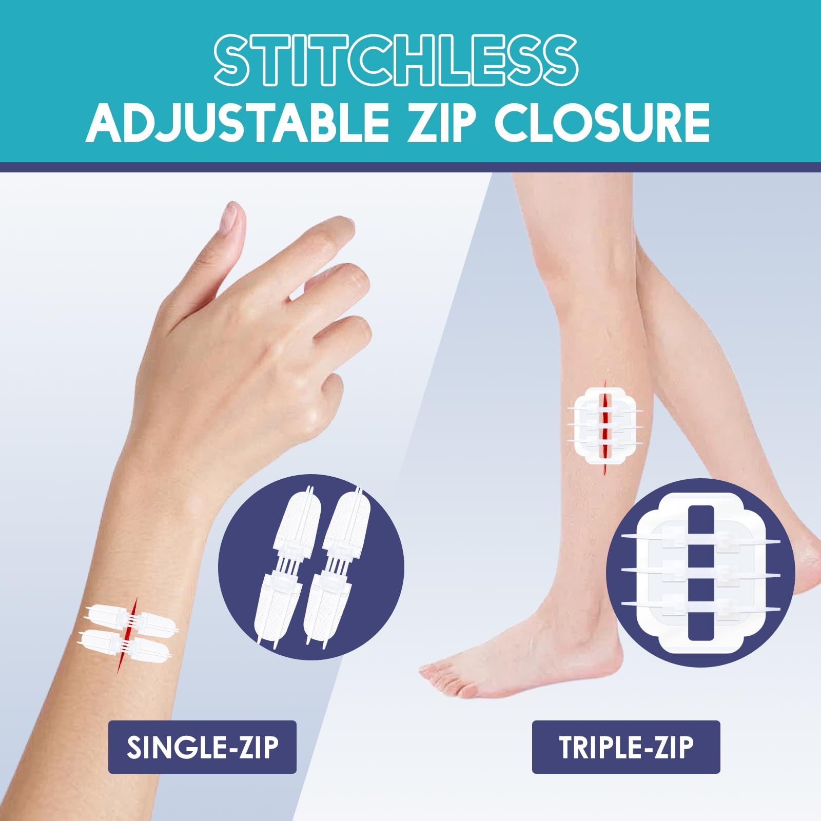 ZMZPA emergency PU closure device supports fast, secure wound approximation.