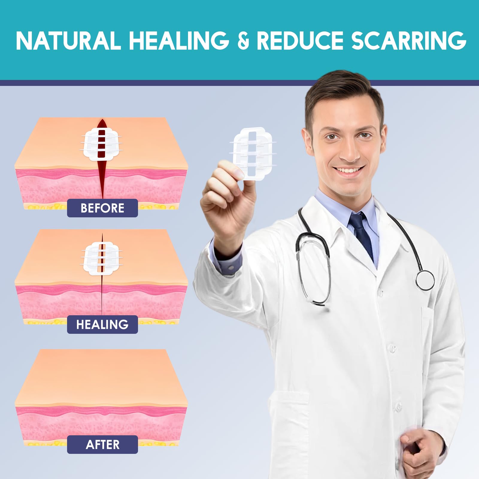 ZMZPA non woven wound closure strips offer simple application and removal.