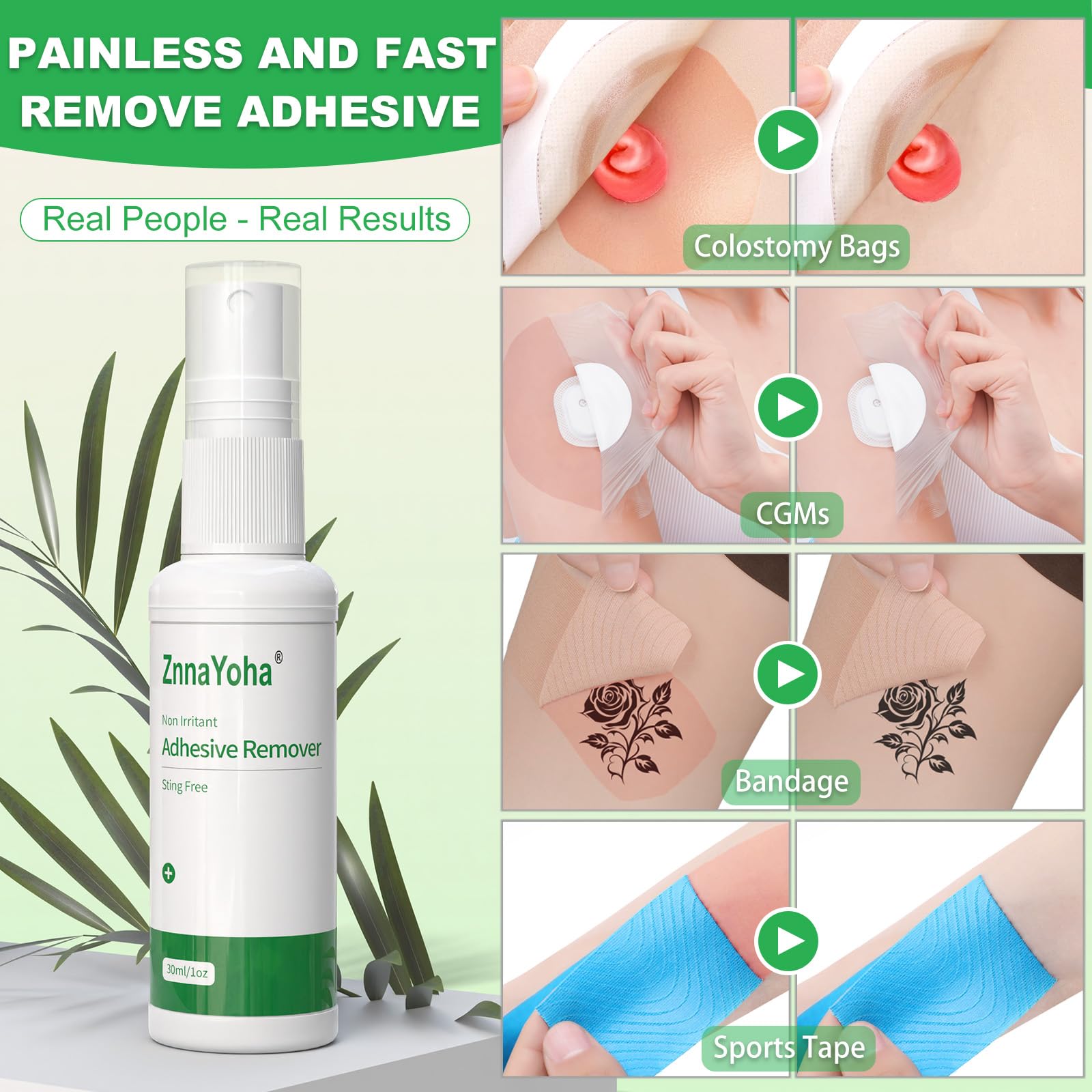 ZnnaYoha no-sting formula provides gentle skin experience during adhesive removal.