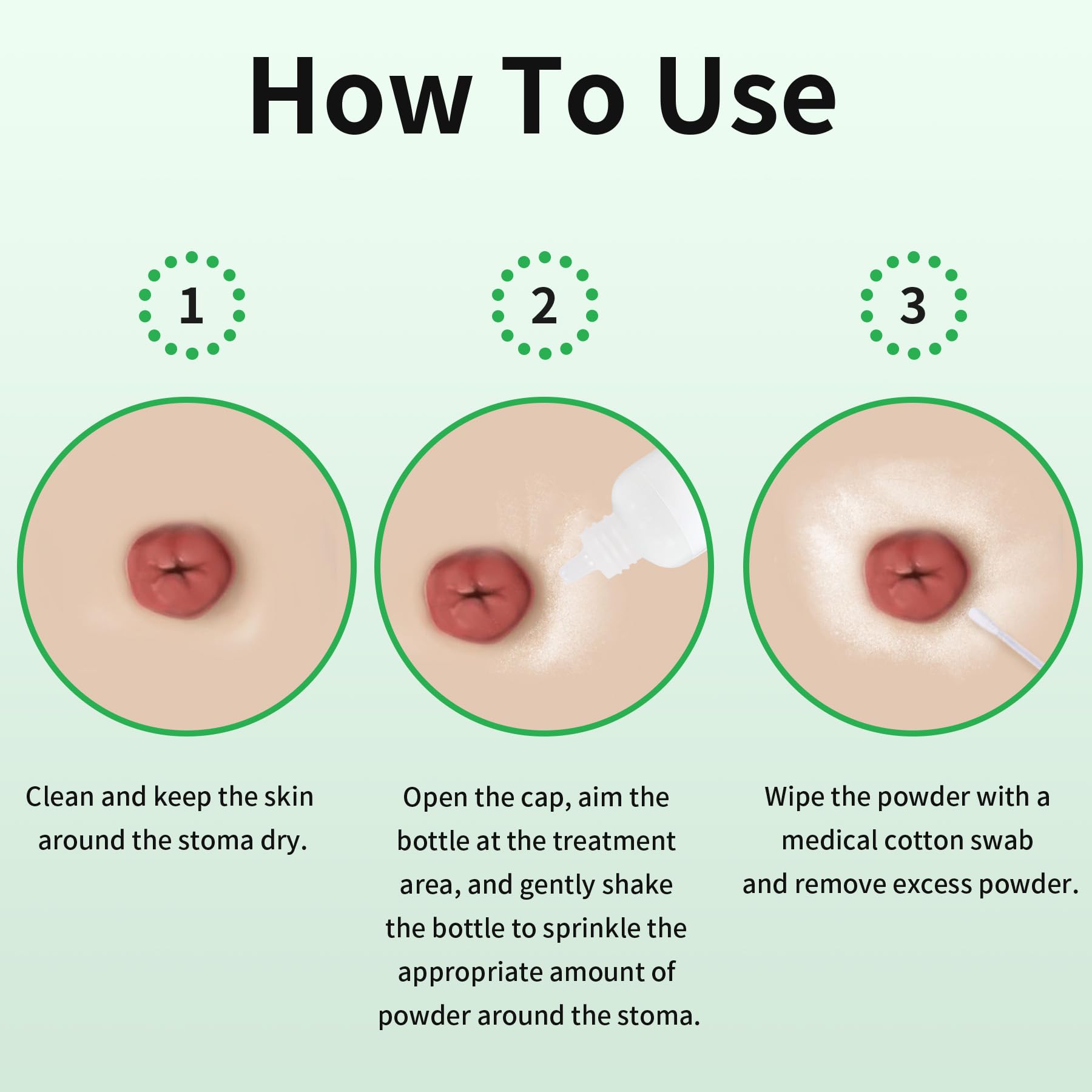 ZnnaYoha stoma powder around stoma skin supports barrier adhesion and comfort.