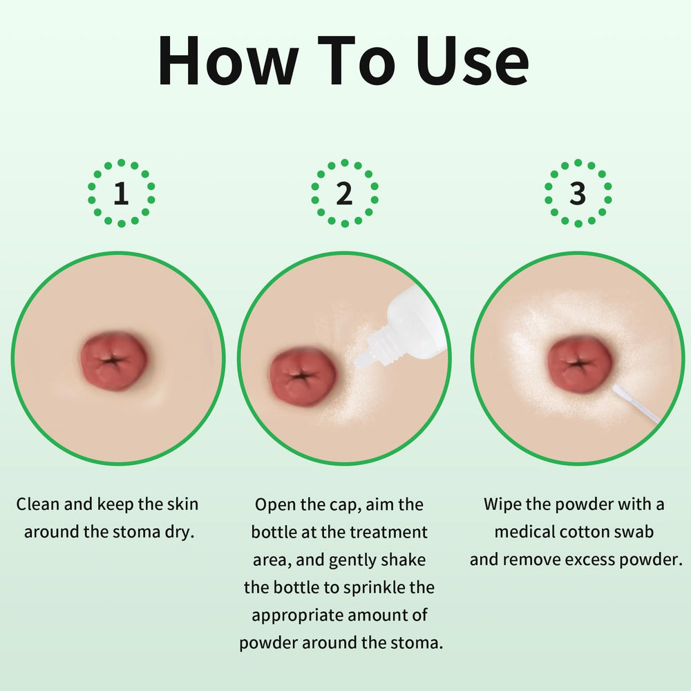 ZnnaYoha stoma powder around stoma skin supports barrier adhesion and comfort.