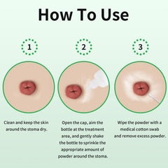 ZnnaYoha stoma powder around stoma skin supports barrier adhesion and comfort.