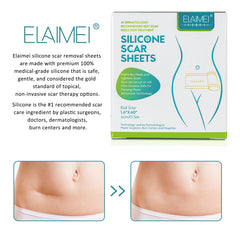 Close-up of medical-grade silicone showing soft, flexible scar sheet.