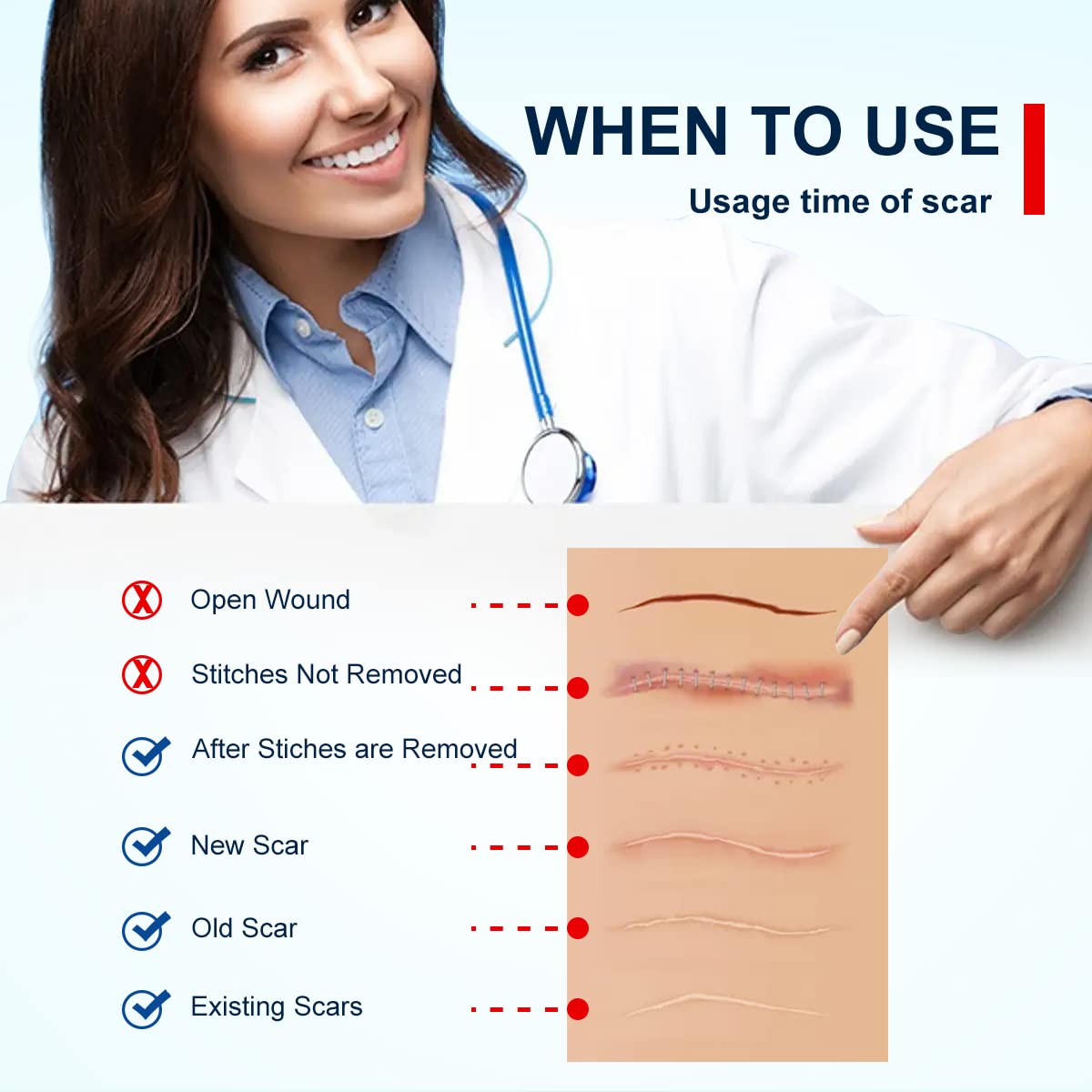 ZODENIS scar tape cut to length for a personalized fit.