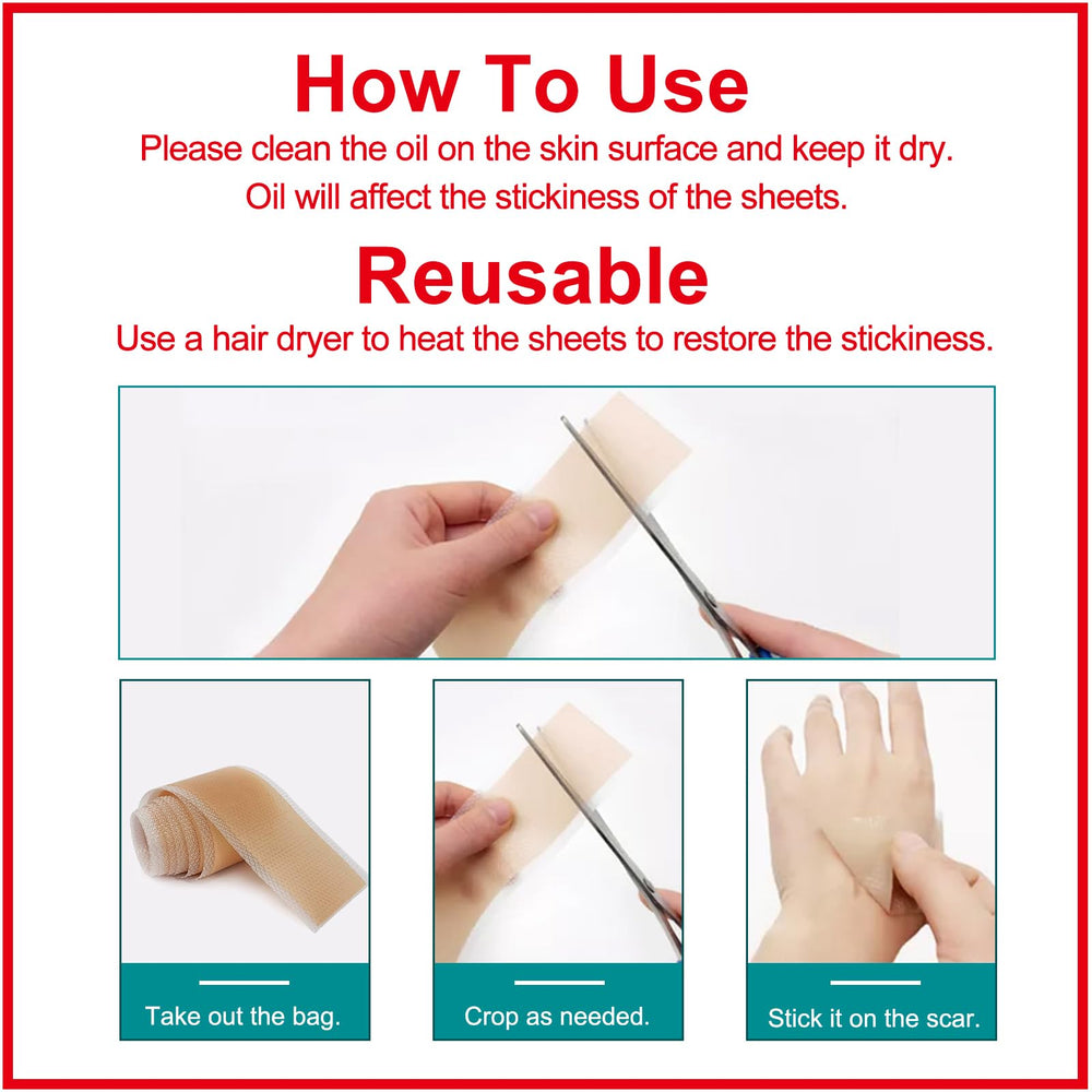 ZODENIS scar sheets applied on a C-section scar for discreet protection