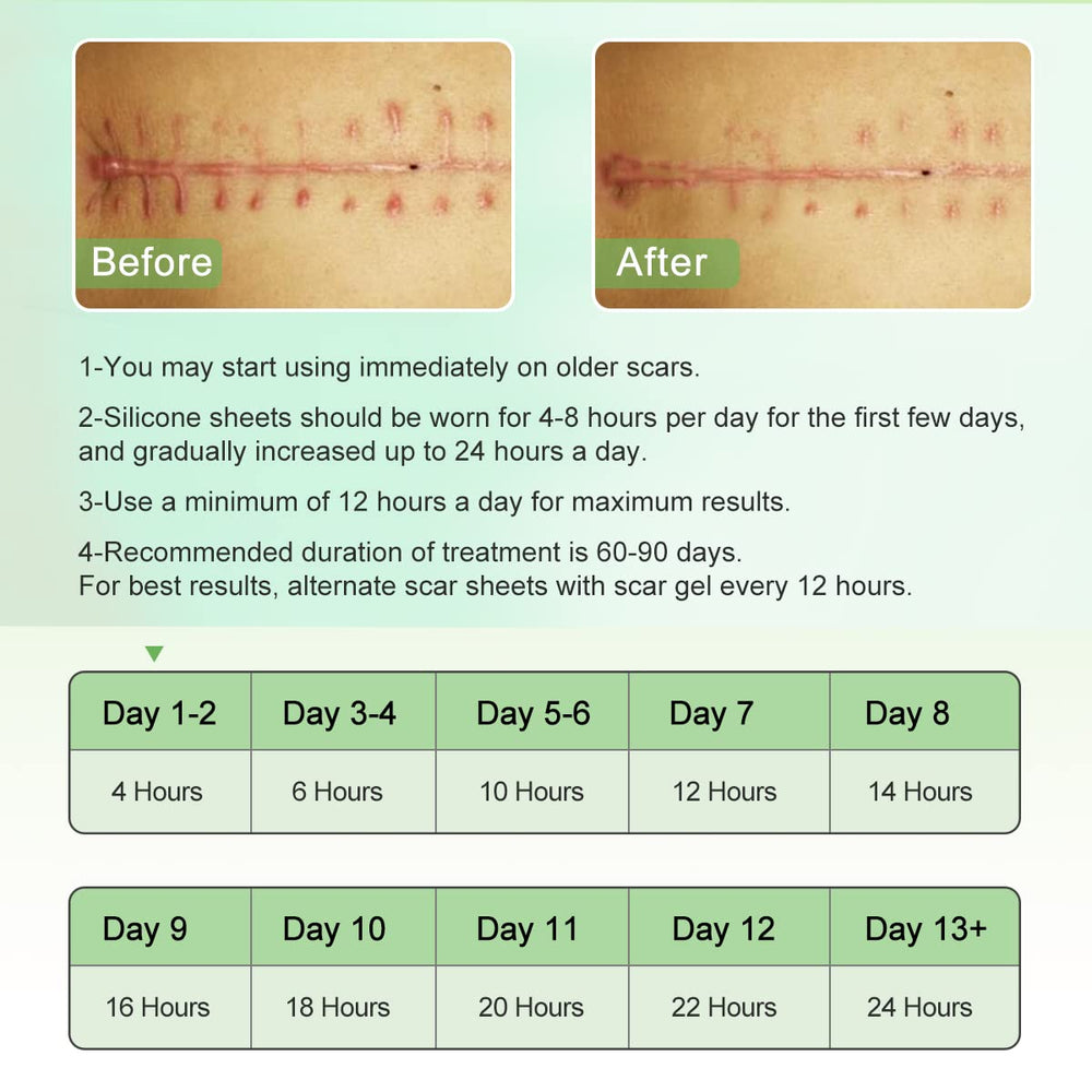 ZODENIS silicone scar sheets reused to protect ongoing scar management