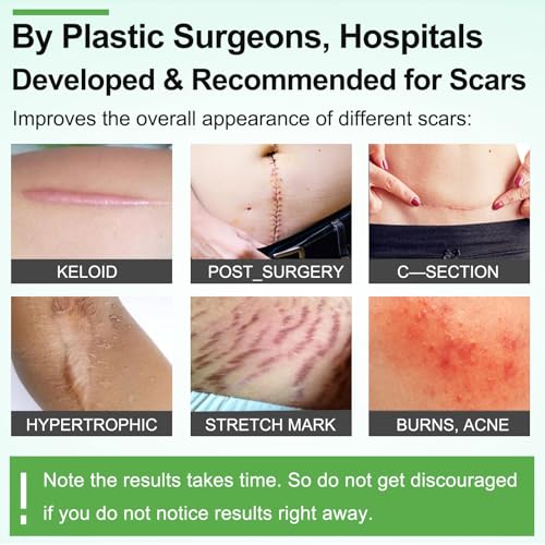 ZODENIS scar sheets safe for children and adults with easy positioning