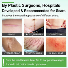 ZODENIS silicone scar tape on a surgical scar provides discreet coverage.