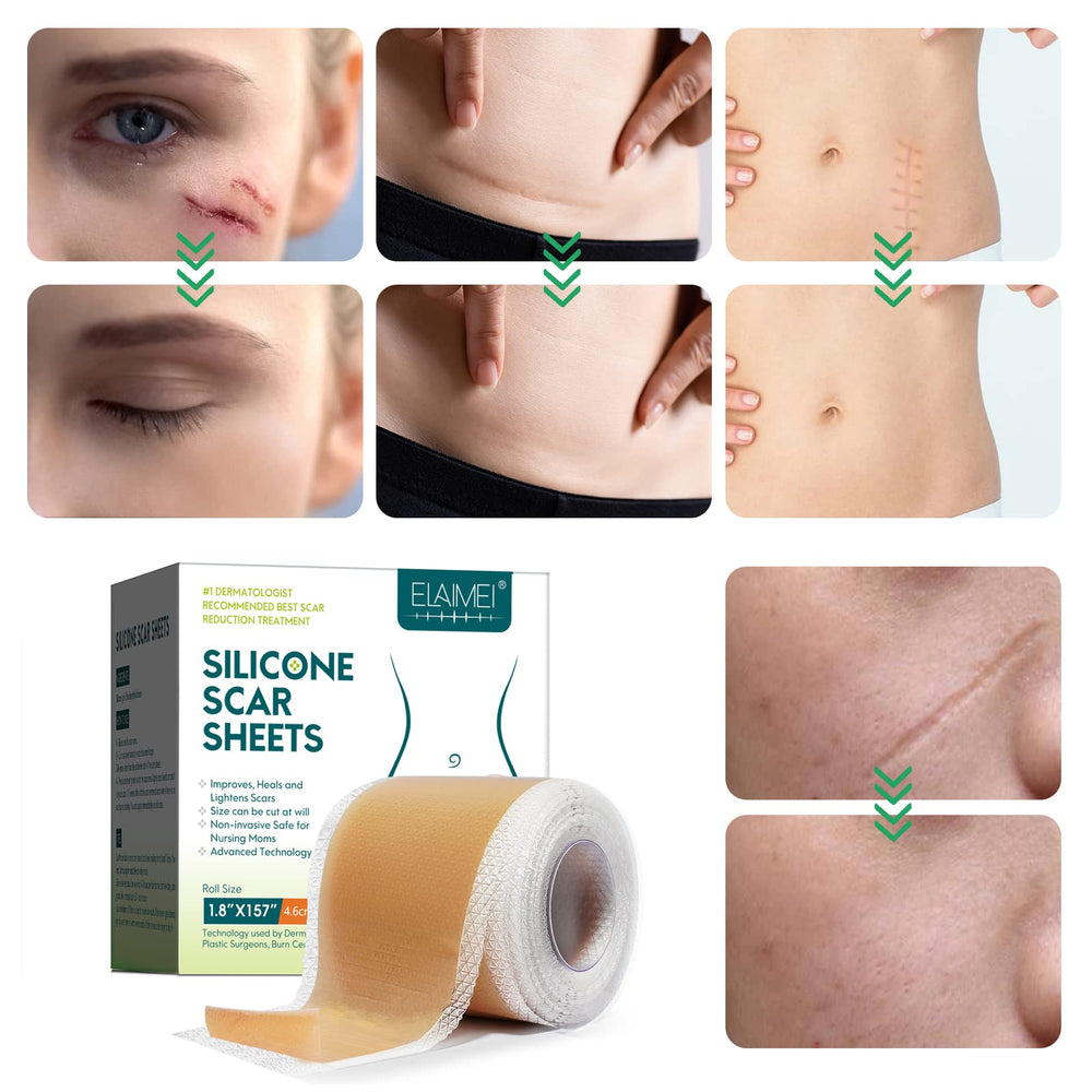 ZODENIS silicone scar tape suitable for various scar types and stages.