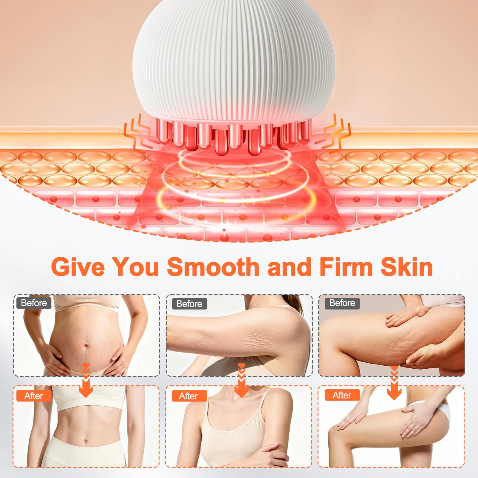 ZRCZRC lymphatic drainage massager arm treatment for targeted contour support.